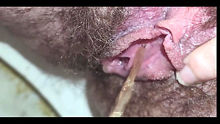 Glimpse the Urethra as It Opens When the Stream of Pee Comes Out