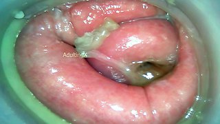 Horny amateur couple close up anal on webcam