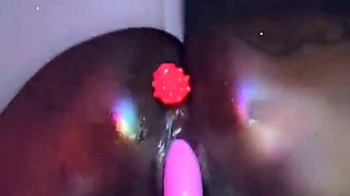 Anal opening