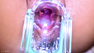 [amateur First Time Filming, Face Revealed] Akari (19) A -time Worker At A Family Restaurant In The Countryside. Internal Filming Of Her Vagina And Anus, And Creampie. Breast Teasing With A Sucking Device Inside. Anal Penetration Followed By Doggy Sty